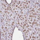 Anti-NRBF2 Antibody