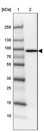 Lane 1: Marker [kDa] 250, 130, 100, 70, 55, 35, 25, 15, 10_br/_Lane 2: Human Testis tissue