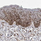 Immunohistochemical staining of human skin shows strong nuclear positivity in squamous epithelial cells.