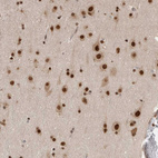 Immunohistochemical staining of human cerebral cortex shows strong nuclear positivity in neurons.