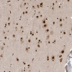 Immunohistochemical staining of human cerebral cortex shows strong nuclear positivity in neurons.