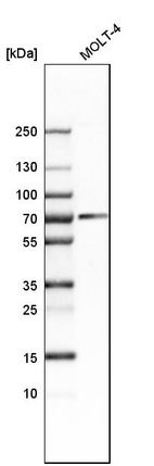 Western blot analysis in human cell line MOLT-4.