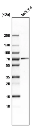 Western blot analysis in human cell line MOLT-4.