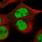 Immunofluorescent staining of human cell line A-431 shows localization to nucleoplasm.