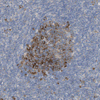 Immunohistochemical staining of human tonsil shows moderate to strong cytoplasmic positivity in germinal center cells.