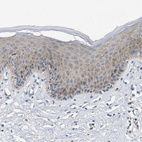 Immunohistochemical staining of human skin shows moderate cytoplasmic positivity in squamous epithelial cells.