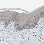 Immunohistochemical staining of human skin shows moderate cytoplasmic positivity in squamous epithelial cells.