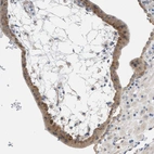Immunohistochemical staining of human placenta shows moderate cytoplasmic positivity in trophoblastic cells.