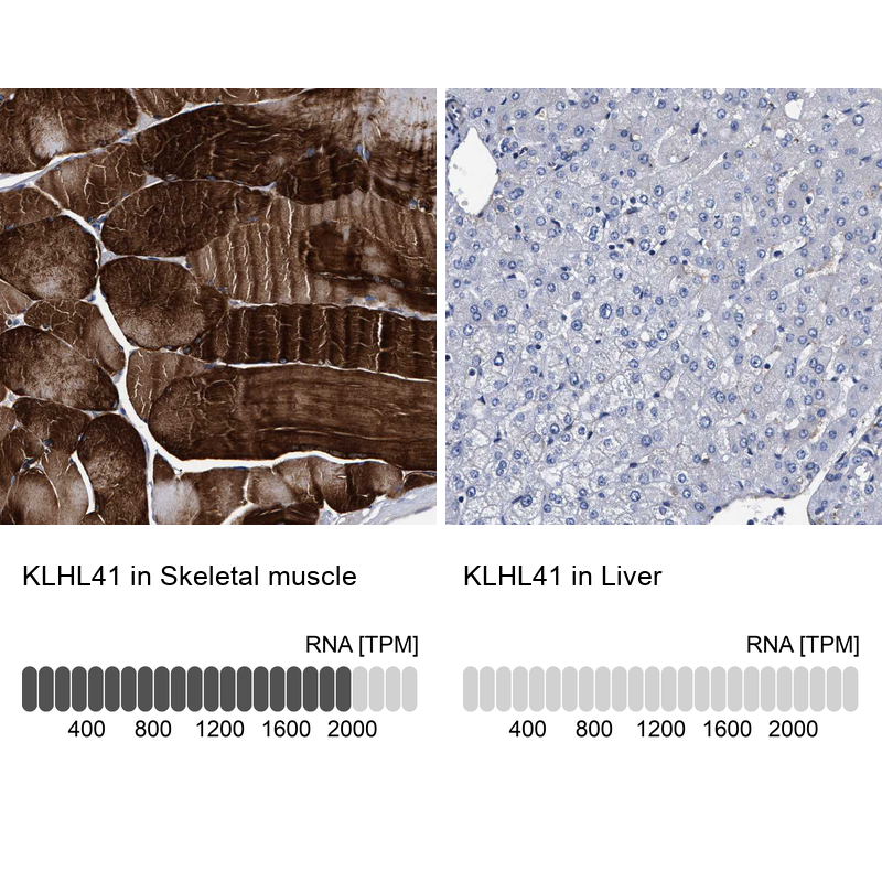 Anti-KLHL41 Antibody