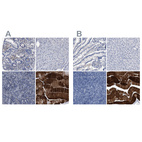Immunohistochemical staining of human gastrointestinal, liver, lymphoid tissues and skeletal muscle using Anti-KLHL41 antibody HPA021753 (A) shows similar protein distribution across tissues to independent antibody HPA021165 (B).
