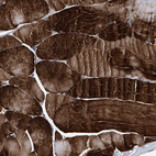 Immunohistochemical staining of human skeletal muscle shows strong cytoplasmic positivity in myocytes.