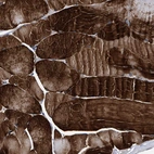 Immunohistochemical staining of human skeletal muscle shows strong cytoplasmic positivity in myocytes.