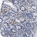 Immunohistochemical staining of human small intestine shows no positivity in glandular cells as expected.