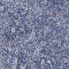 Immunohistochemical staining of human tonsil shows no positivity in non-germinal center cells as expected.