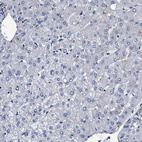 Immunohistochemical staining of human liver shows no positivity in hepatocytes as expected.