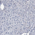 Immunohistochemical staining of human liver shows no positivity in hepatocytes as expected.