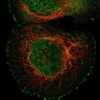 Immunofluorescent staining of human cell line A-431 shows localization to nucleus, plasma membrane & cytosol.