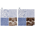 Immunohistochemical staining of human gastrointestinal, liver, lymphoid tissues and skeletal muscle using Anti-KLHL41 antibody HPA021760 (A) shows similar protein distribution across tissues to independent antibody HPA021165 (B).