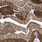 Immunohistochemical staining of human skeletal muscle shows strong cytoplasmic positivity in myocytes.