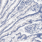 Immunohistochemical staining of human small intestine shows no positivity in glandular cells as expected.