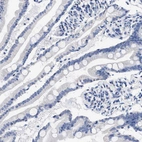 Immunohistochemical staining of human small intestine shows no positivity in glandular cells as expected.