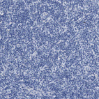 Anti-KLHL41 Antibody