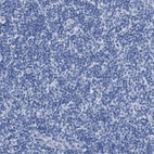Immunohistochemical staining of human tonsil shows no positivity in non-germinal center cells as expected.