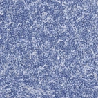 Immunohistochemical staining of human tonsil shows no positivity in non-germinal center cells as expected.