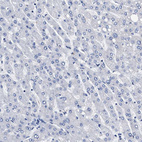 Immunohistochemical staining of human liver shows no positivity in hepatocytes as expected.