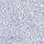 Immunohistochemical staining of human liver shows no positivity in hepatocytes as expected.