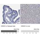 Anti-CROCC Antibody