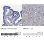 Anti-CROCC Antibody