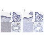 Immunohistochemical staining of human bronchus, fallopian tube, liver and testis using Anti-CROCC antibody HPA021762 (A) shows similar protein distribution across tissues to independent antibody HPA021191 (B).