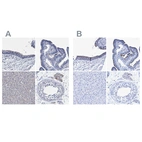 Immunohistochemical staining of human bronchus, fallopian tube, liver and testis using Anti-CROCC antibody HPA021762 (A) shows similar protein distribution across tissues to independent antibody HPA021191 (B).