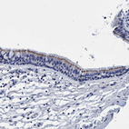 Immunohistochemical staining of human bronchus shows moderate membranous positivity in respiratory epithelial cells.