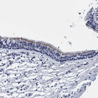 Immunohistochemical staining of human bronchus shows moderate membranous positivity in respiratory epithelial cells.