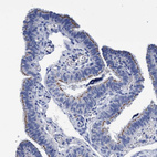 Immunohistochemical staining of human Fallopian tube shows moderate membranous positivity in glandular cells.