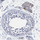 Immunohistochemical staining of human testis shows weak cytoplasmic positivity in Leydig cells.