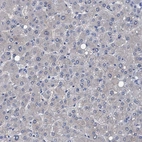 Immunohistochemical staining of human liver shows no positivity in hepatocytes as expected.
