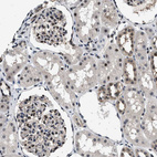 Immunohistochemical staining of human kidney shows strong nuclear positivity in cells in glomeruli.