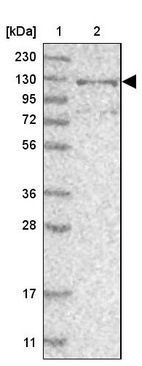 Lane 1: Marker [kDa] 230, 130, 95, 72, 56, 36, 28, 17, 11_br/_Lane 2: Human cell line RT-4
