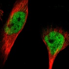 Immunofluorescent staining of human cell line U-251 MG shows localization to nucleoplasm.