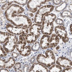 Anti-CHRDL2 Antibody