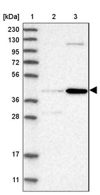 Lane 1: Marker [kDa] 230, 130, 95, 72, 56, 36, 28, 17, 11_br/_Lane 2: Human cell line RT-4_br/_Lane 3: Human cell line U-251MG sp