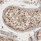 Immunohistochemical staining of human testis shows strong nuclear positivity in cells in seminiferous ducts.