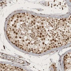 Immunohistochemical staining of human testis shows strong nuclear positivity in cells in seminiferous ducts.