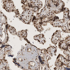 Immunohistochemical staining of human placenta shows strong nuclear positivity in trophoblastic cells.