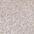Immunohistochemical staining of human liver shows very weak positivity in hepatocytes as expected.