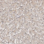 Immunohistochemical staining of human liver shows very weak positivity in hepatocytes as expected.