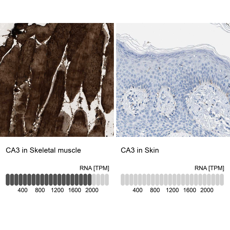 Anti-CA3 Antibody